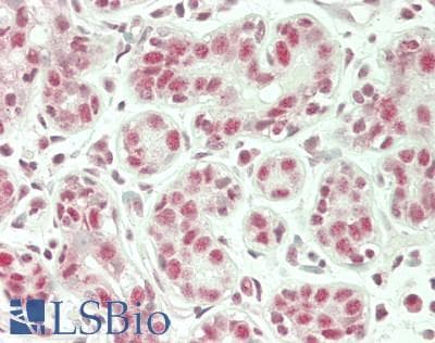 IHC-plus™ Polyclonal Rabbit anti-Human NBN / Nibrin Antibody (aa425-475, IHC, WB)