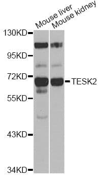 TESK2 Antibody
