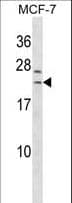SAP30L Antibody (aa106-134)