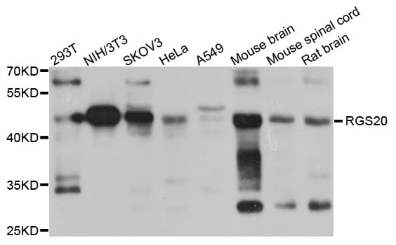 RGS20 / RGSZ1 Antibody