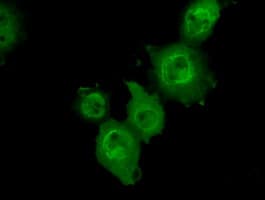 MAPK11 / SAPK2 / p38 Beta Antibody (clone OTI1C2)