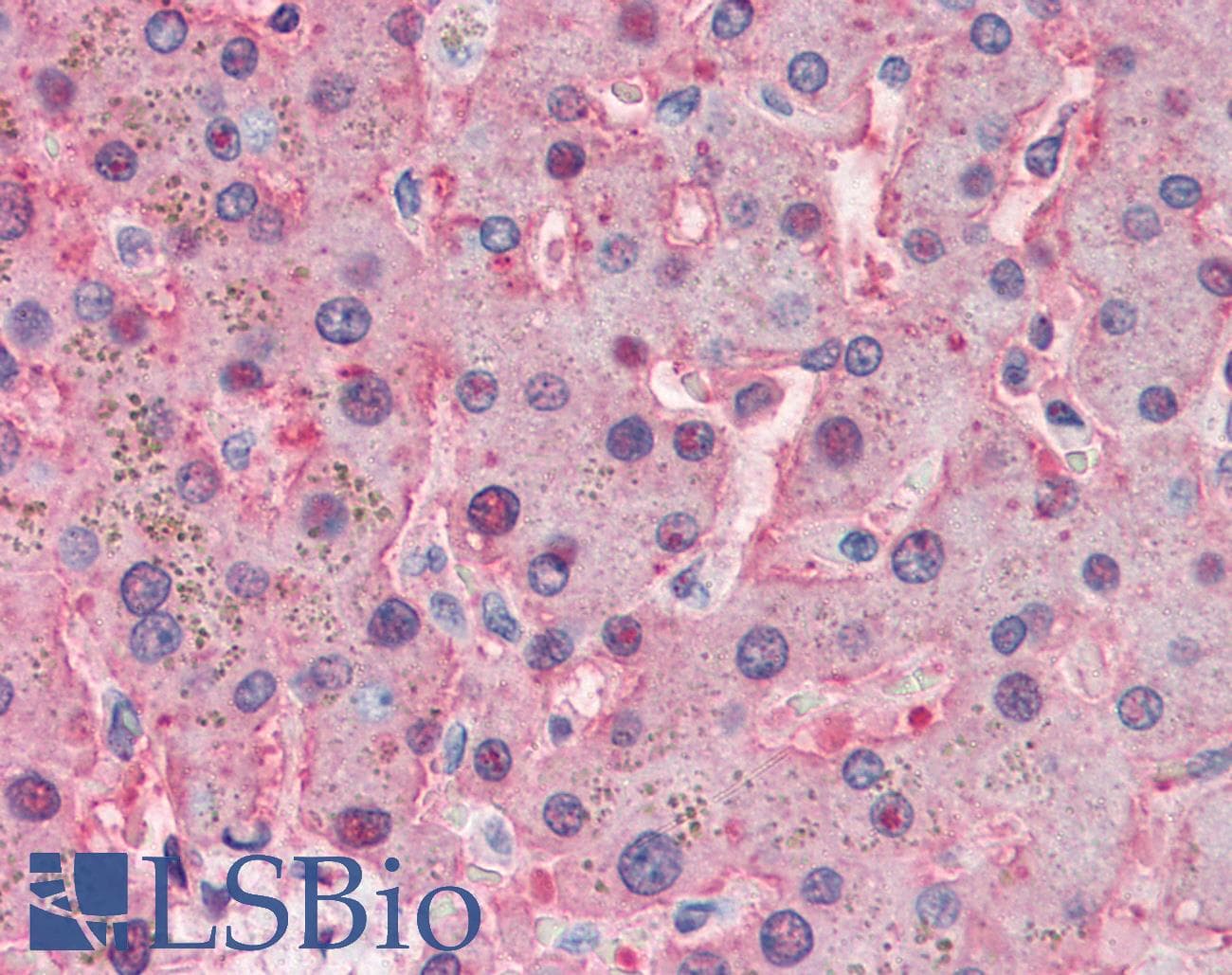 IHC-plus™ Polyclonal Rabbit anti-Human TF / Transferrin Antibody (IHC, WB)