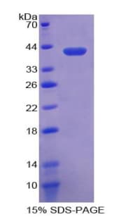 Human CRY Protein (Recombinant His-S)