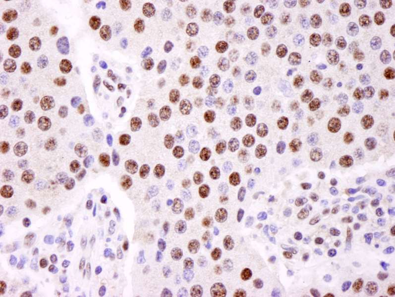 Polyclonal Rabbit anti-Human HNRNPK / hnRNP K Antibody (C-Terminus, IHC)