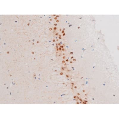 LIMK2 Antibody (phospho-Ser283)