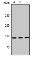 Polyclonal Rabbit anti-Human IRS Antibody (WB)