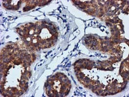FGFR2 / FGF Receptor 2 Antibody (clone OTI3F8)