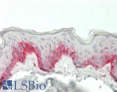 Polyclonal Rabbit anti-Human FGF23 Antibody (aa79-160, IHC, WB)