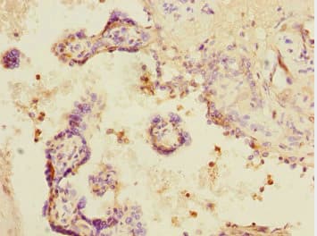 SMIF / DCP1A Antibody
