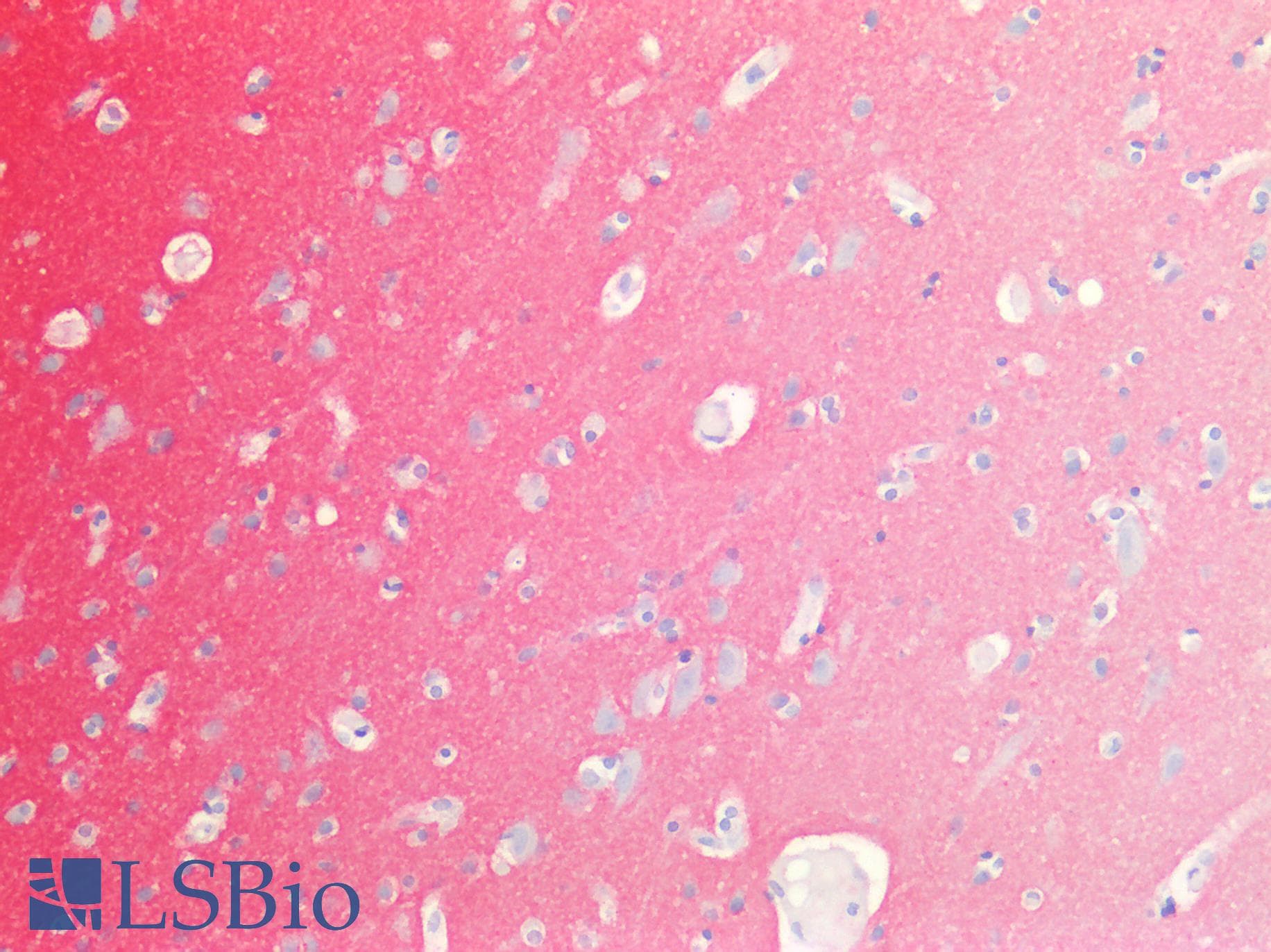 PathPlus™ Monoclonal Mouse anti-Human SIRPA / CD172a Antibody (clone 03, aa1-370, IHC)