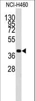 LECT1 / Chondromodulin-I Antibody (aa253-281)