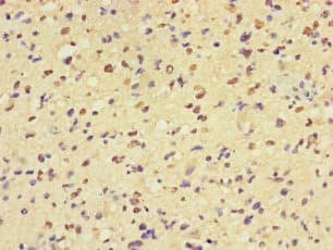 MAP3K8 / TPL2 Antibody