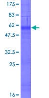 Human ICMT / PPMT Protein (Recombinant GST)