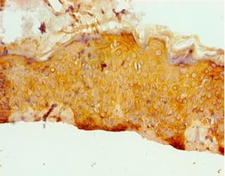 ERCC2 / XPD Antibody (aa1-300)