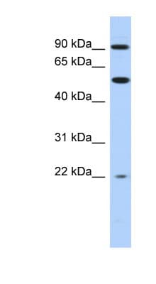 Polyclonal Rabbit anti-Human NR1D2 Antibody (aa503-552, WB)