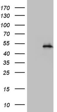 NR2C1 Antibody (aa1-237, clone OTI4E4)