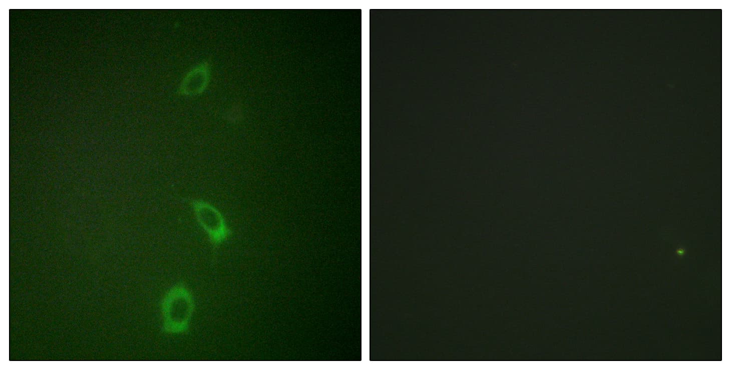 Polyclonal Rabbit anti-Human KCNJ1 / ROMK Antibody (aa11-60, IF)