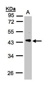 Polyclonal Rabbit anti-Human PDCL Antibody (aa1-244, WB)