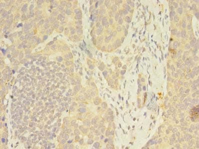 Polyclonal Rabbit anti-Human FKBP11 Antibody (IHC, WB)