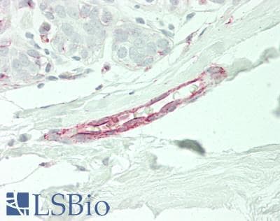 IHC-plus™ ETK / BMX Antibody (N-Terminus)