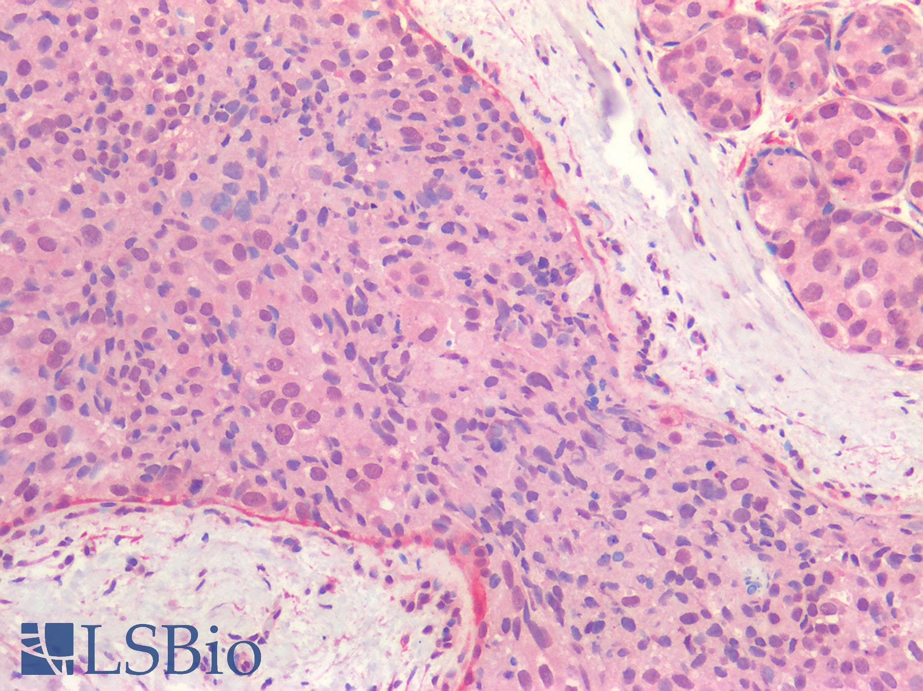 PathPlus™ ER Alpha / Estrogen Receptor Antibody