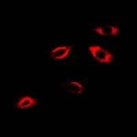 Polyclonal Rabbit anti-Human APRT Antibody (IF, WB)