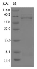 Human MLYCD / MCD Protein (Recombinant 10His, N-terminus + Myc, C-terminus)