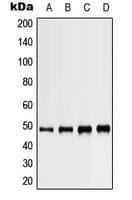 IHC-plus™ Polyclonal Rabbit anti-Human KCNJ5 / Kir3.4 / GIRK4 Antibody (C-Terminus, IHC, WB)