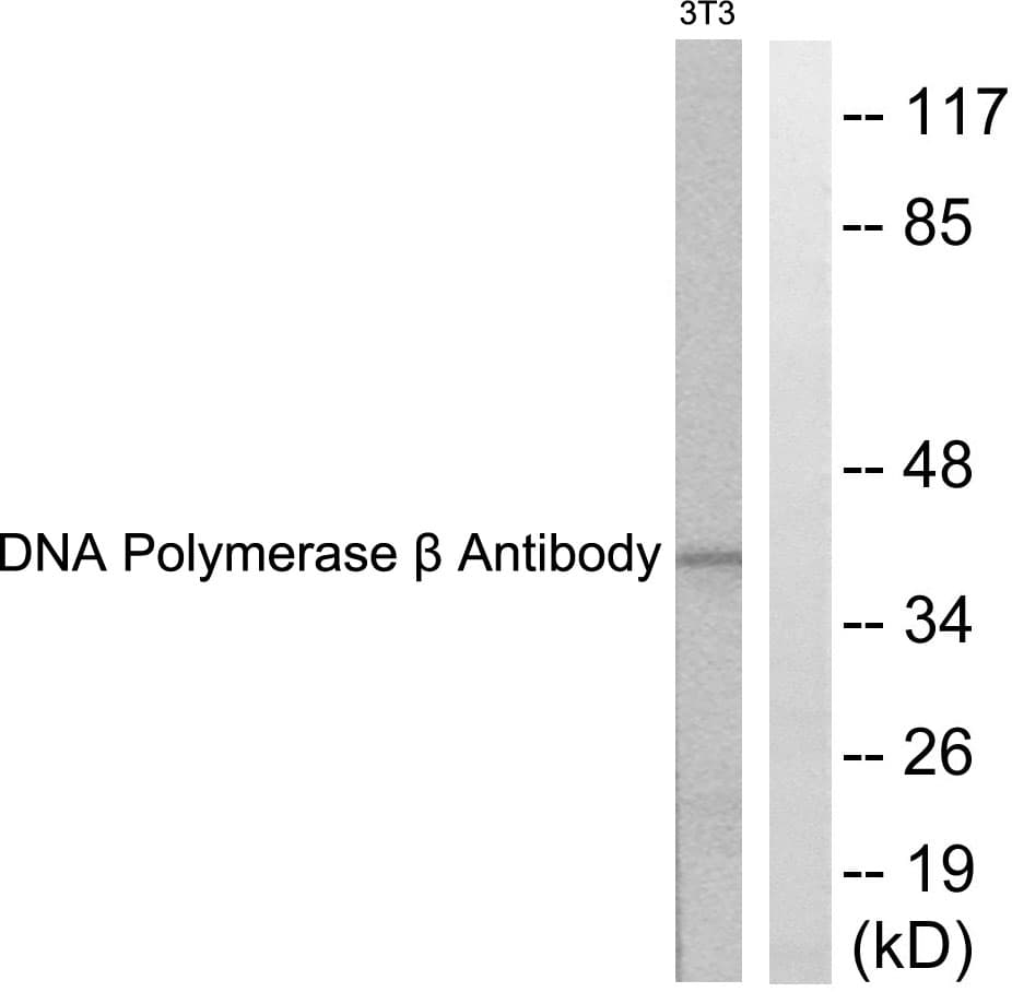 IHC-plus™ POLB / DNA Polymerase Beta Antibody (aa286-335)