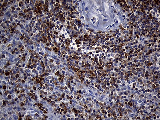 SH3BP1 Antibody (clone OTI1C9)