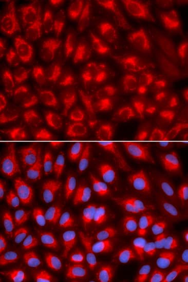 MtTFA / TFAM Antibody