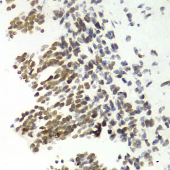 MSH6 Antibody