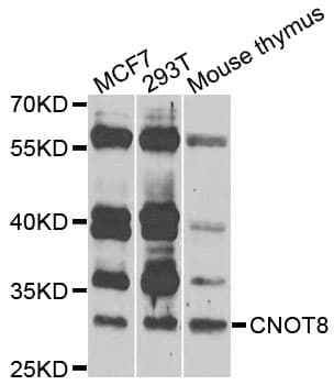 IHC-plus™ Polyclonal Rabbit anti-Human CNOT8 Antibody (IHC, WB)