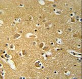 Polyclonal Rabbit anti-Human BABAM1 / HSPC142 Antibody (aa9-37, IHC, WB)
