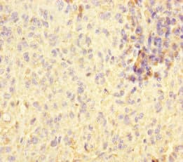 Polyclonal Rabbit anti-Human STOML2 Antibody (IHC)