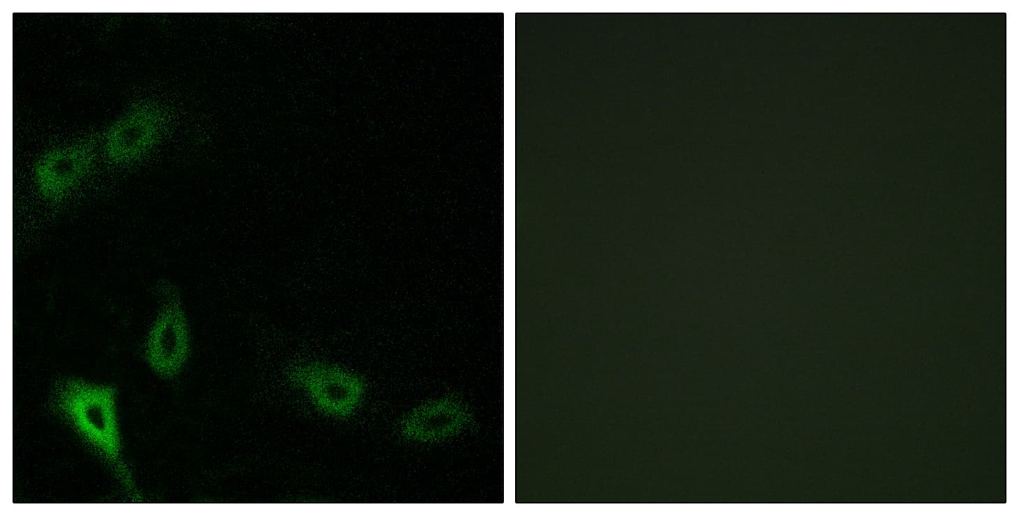 IHC-plus™ Polyclonal Rabbit anti-Human MARK2 Antibody (aa10-59, IHC, IF, WB)