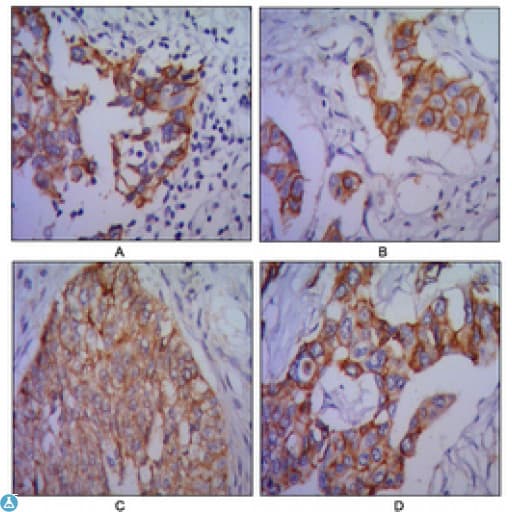 CDH2 / N Cadherin Antibody