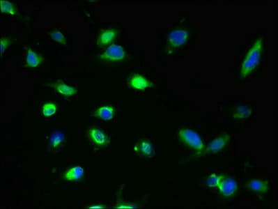 GDPD2 / GDE3 Antibody