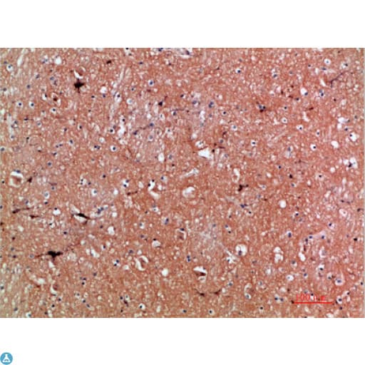 TNR / Tenascin R Antibody