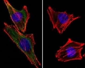 S100B / S100 Beta Antibody (clone S100B/1012, Ready-to-Use)