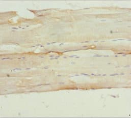 NPHP3 Antibody