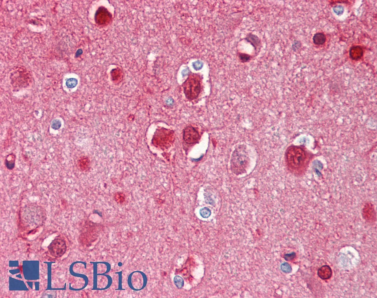 IHC-plus™ BCHE / Cholinesterase Antibody