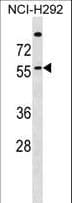 Polyclonal Rabbit anti-Human ZDHHC13 / HIP14L Antibody (aa55-83, WB)