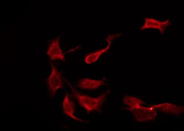 KCNMB2 Antibody