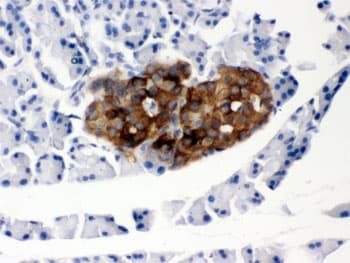 Polyclonal Rabbit anti-Human PRNP / PrP / Prion Antibody (IHC, WB)