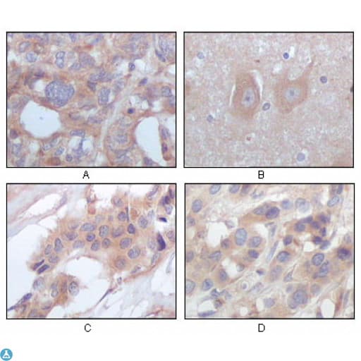 Monoclonal Mouse anti-Human STYK1 Antibody (IHC, WB)