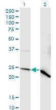 Monoclonal Mouse anti-Human NDUFV2 Antibody (clone 1A10, WB)