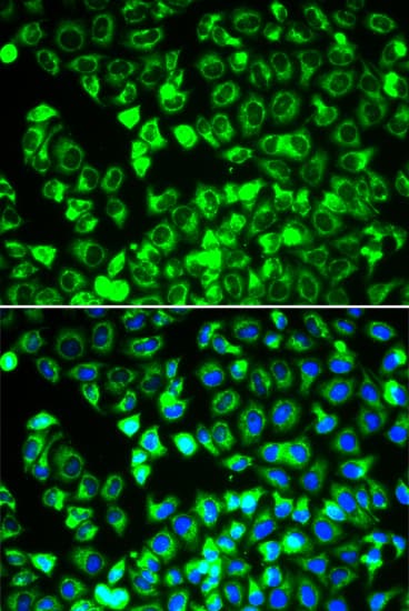 DLD / Diaphorase / E3 Antibody