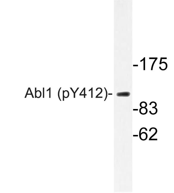 ABL1 / c-ABL Antibody (phospho-Tyr412)