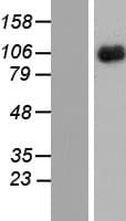 Human CSF2RB / CD131 Protein (Over-Expression Lysate Myc-DDK (Flag))